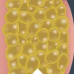 Fat Cells Closeup 1